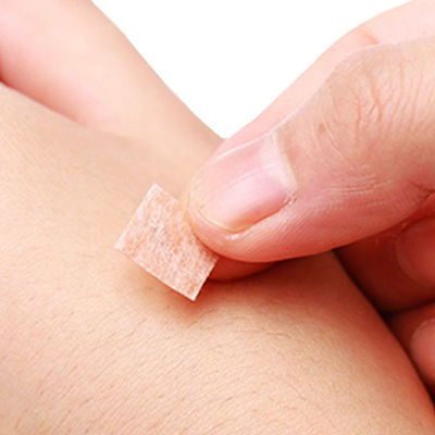 Scherpe Naaldpunt Roestvrijstalen Acupunctuurnaalden voor Nauwkeurige Prestaties