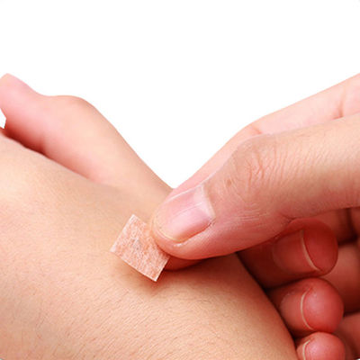 GB 2024-2016 Acupunctuur Druknaalden 0,2 mm X 1,5 mm voor Chinese Geneeskunde Apparaat Eigenschappen Veiligheidsstandaard